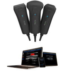 Handheld Color Doppler Ultrasound Scanner